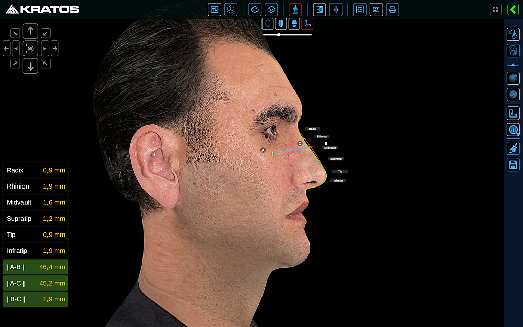 How AI Is Replacing the $50,000 Scanner in Your Surgeon’s Office